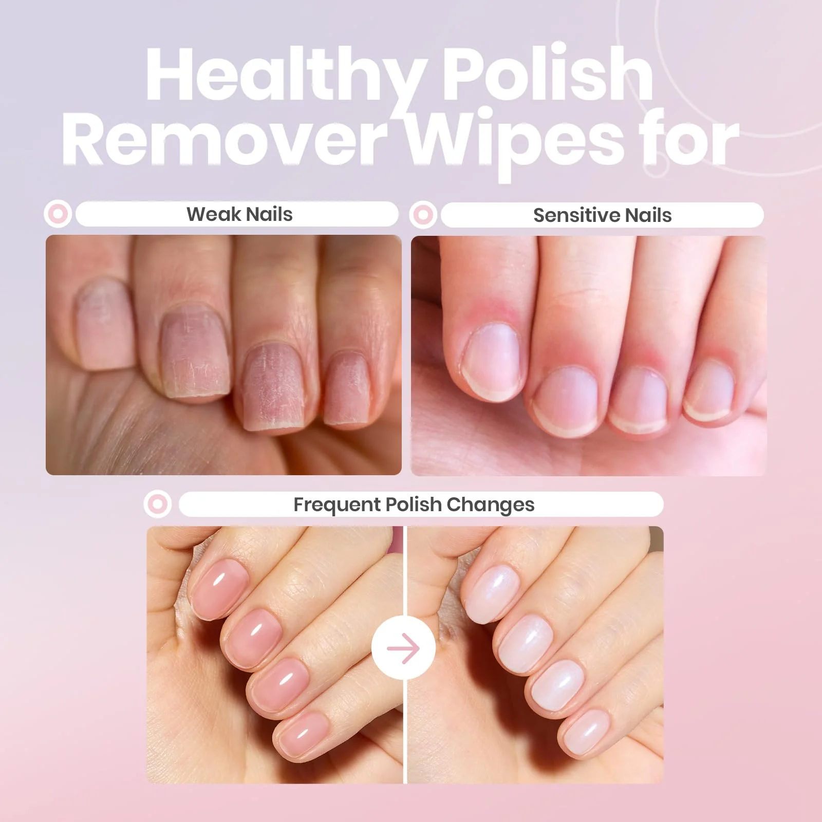 Beetles Nail Polish Remover 250ML Gentle Nourishing Nail Care - Image 6