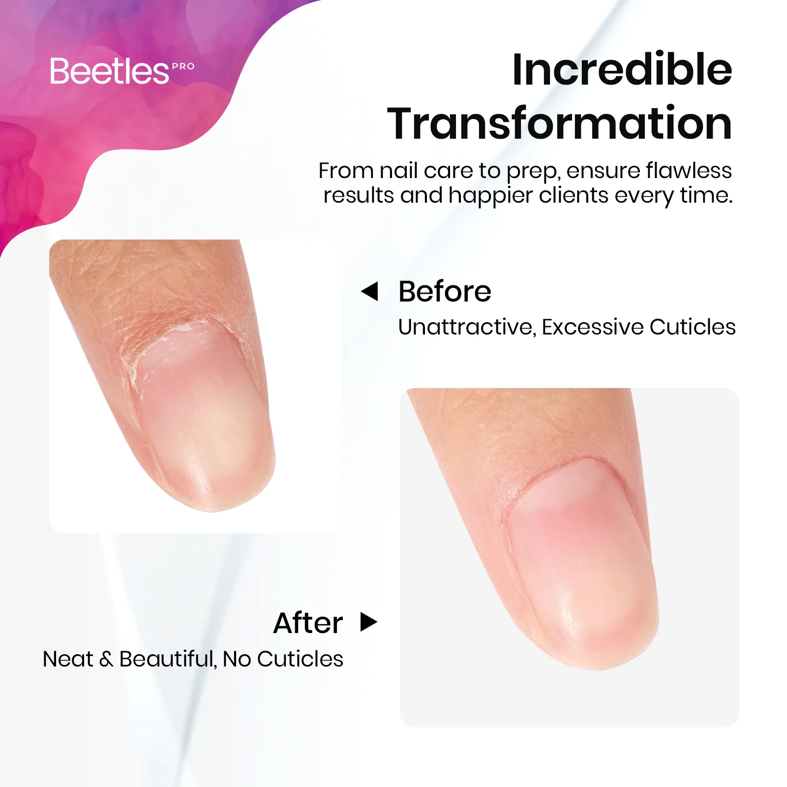 Beetles Pro Cuticle Trimmer Curved Blade(5mm) & Serrated Edge(14mm) - Image 6