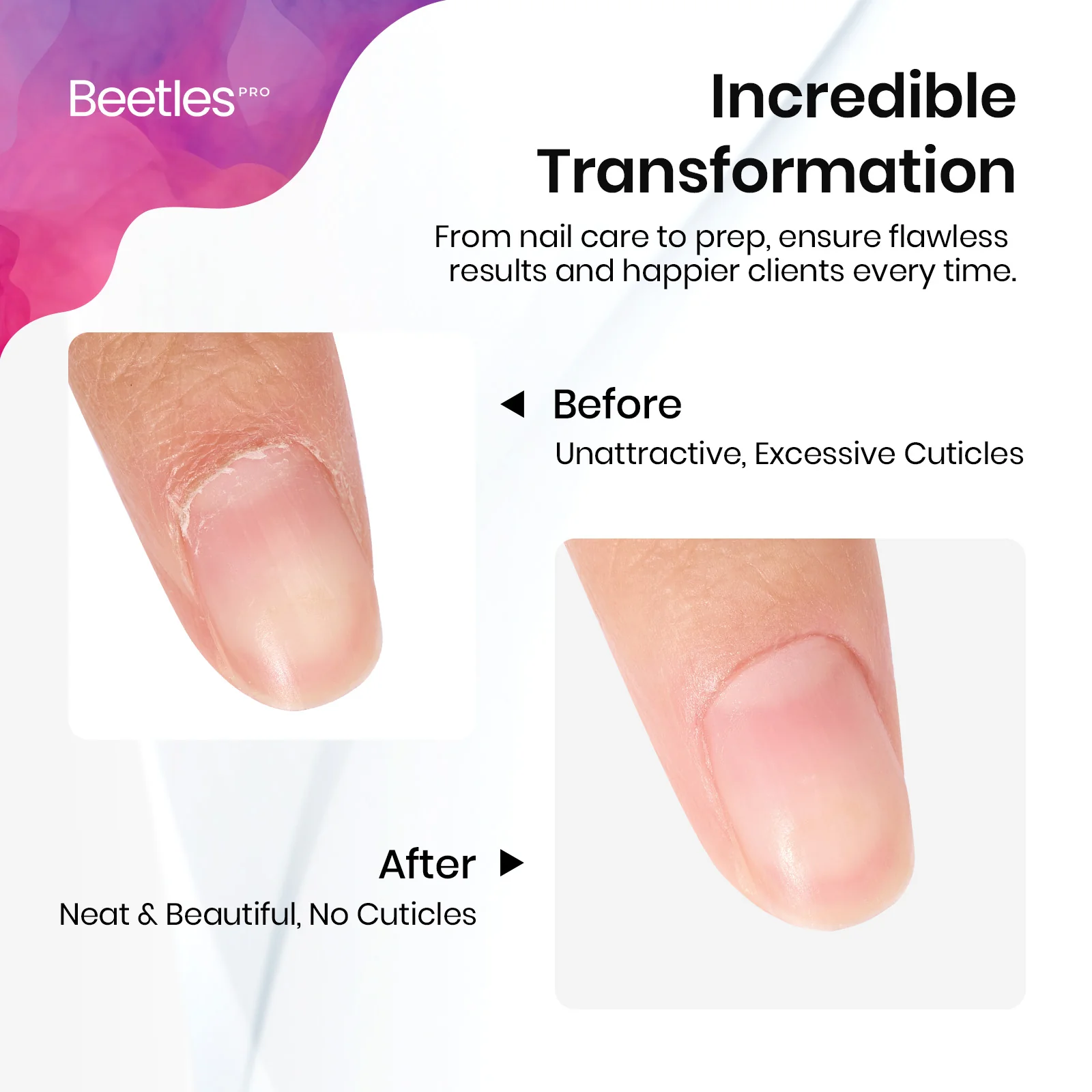 Beetles Pro Cuticle Trimmer Straight Pusher(14mm) & Straight Blade(15mm) - Image 6