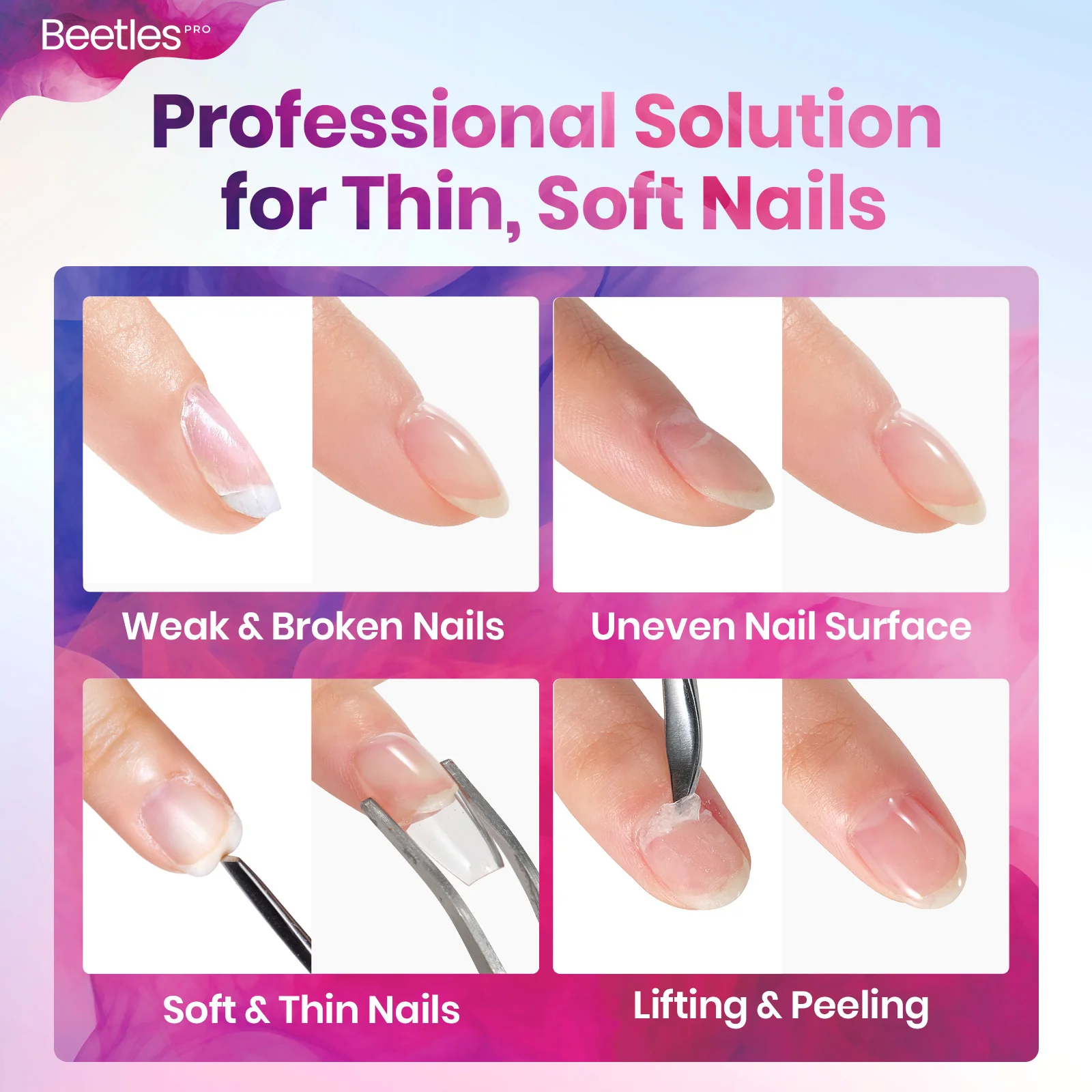 Beetles Pro HEMA Free TPO Free Floform Builder - Image 4